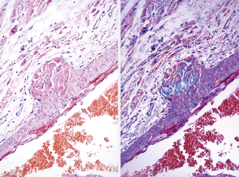 Congo Red, Amyloid Special Stain Kit Leica
